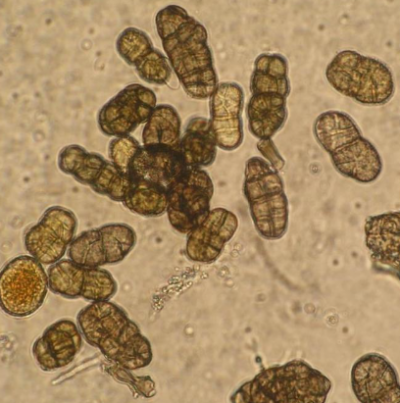 병원균(분생포자)