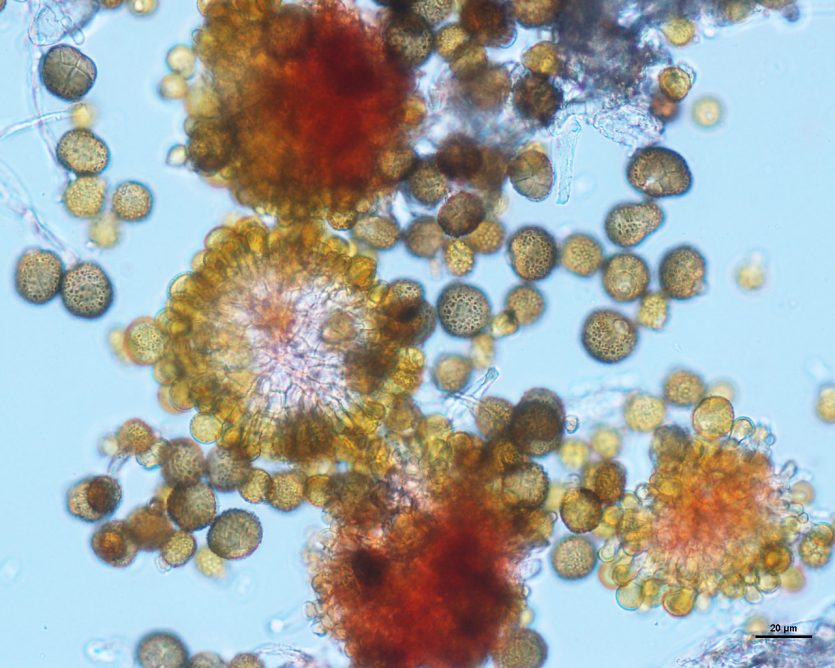 보리 깜부기병 병원균 (U. nuda)