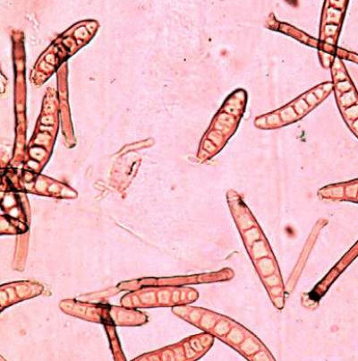 옥수수 깨시무늬병 병원균 분생포자
