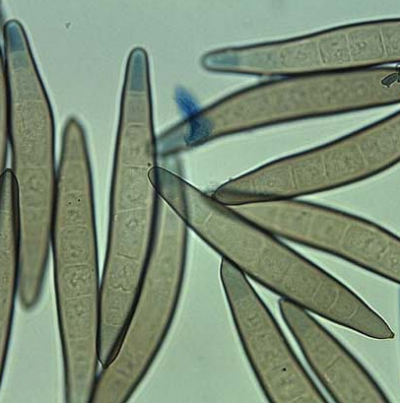 옥수수 잎마름병 병원균 분생포자