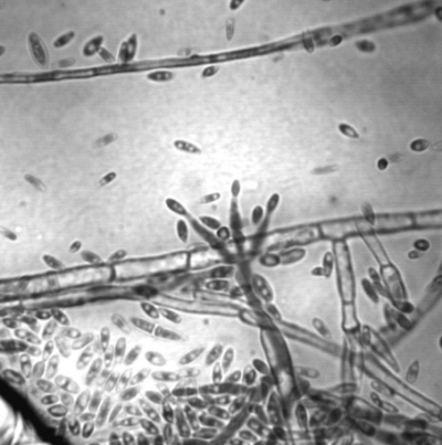병원균 F. verticillioides 분생포자