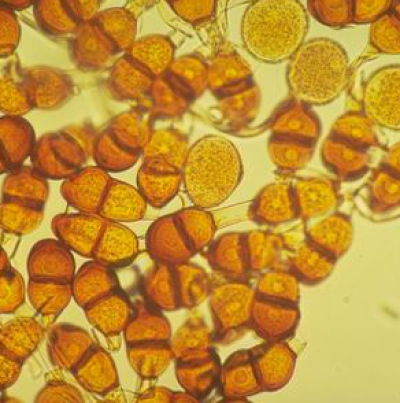 옥수수 녹병 병원균 동포자
