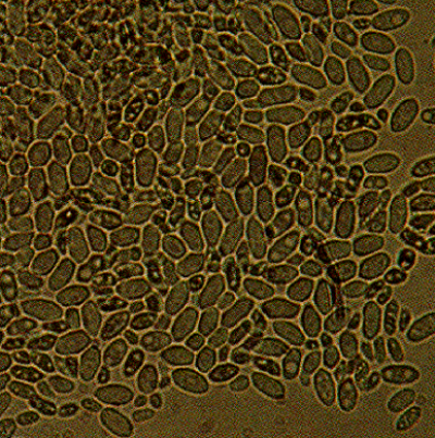 보리 세팔로스포리움줄무늬병 병원균 분생포자