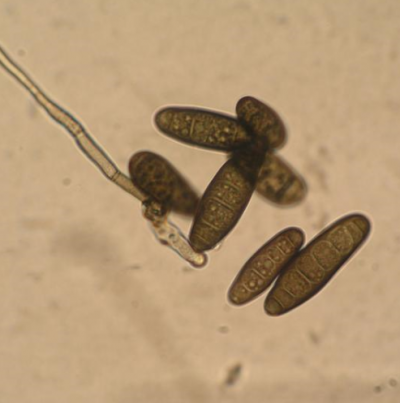 보리 점무늬병 병원균 분생포자