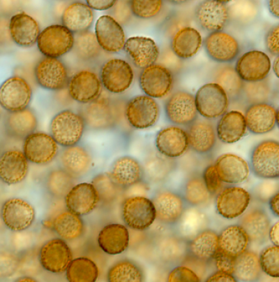 옥수수 깜부기병 병원균 후막포자