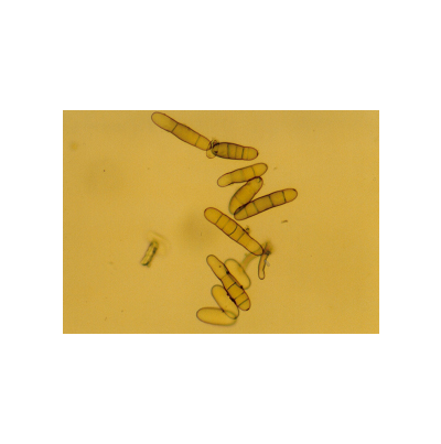 보리 줄무늬병 병원균 분생포자