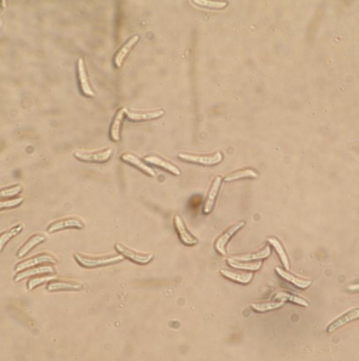 보리 구름무늬병 병원균 분생포자