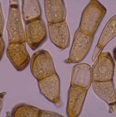 보리 녹병 병원균 동포자