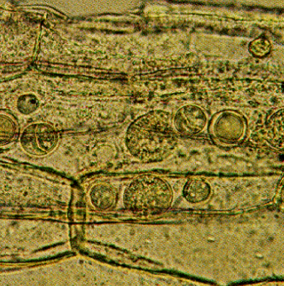 보리 노균병 엽초(잎집) 내의 난포자