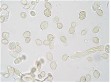 병원균( M. laxa) 분생포자 