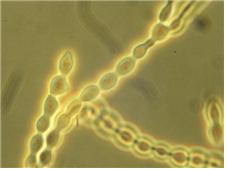 병원균( M. fructicola) 분생포자 사슬