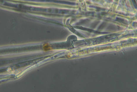 감자 흰비단병 병원균 균사
