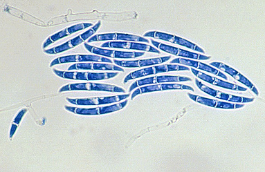 감자 마른썩음병 병원균 분생포자