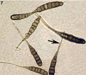 감자 겹둥근무늬 병원균 분생포자