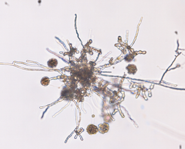 감자 줄기기부썩음병 병원균 난포자 2
