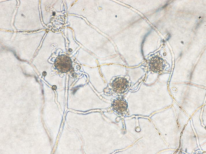 감자 줄기기부썩음병 병원균 난포자