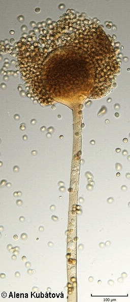 고구마 무름병 병원균 포자 2