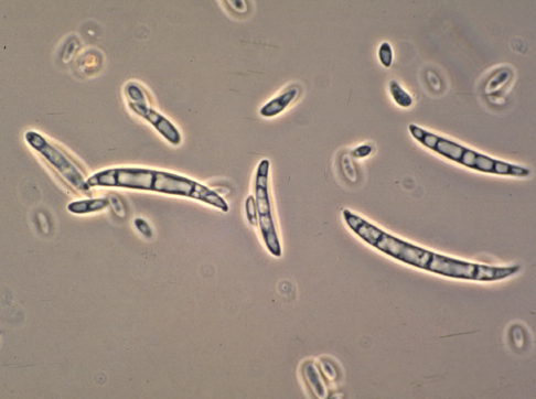 감자 시들음병 병원균 분생포자