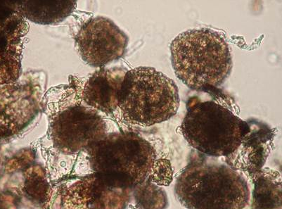 감자 가루더뎅이병 병원균 포자낭