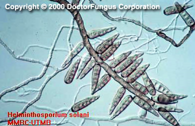 감자 은무늬병 병원균 분생포자