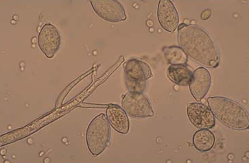 감자 역병 병원균 유주자낭