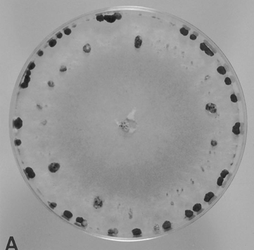PDA 배지에 배양한 감자 균핵병 병원균의 균핵 형성