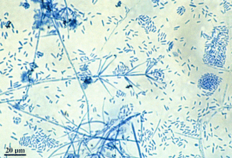 감자 반쪽시들음병 병원균 분생포자