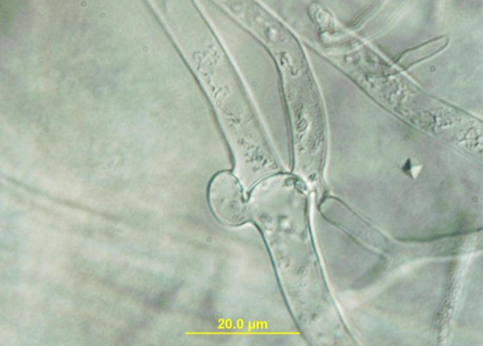 감자 흰비단병 병원균 균사 2