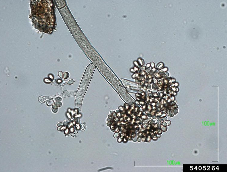 감자 잿빛곰팡이병 병원균 분생포자