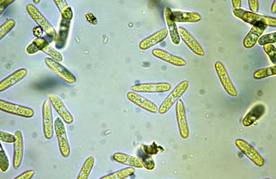 감자 탄저병 병원균 분생포자