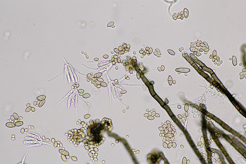 병원균(분생포자)