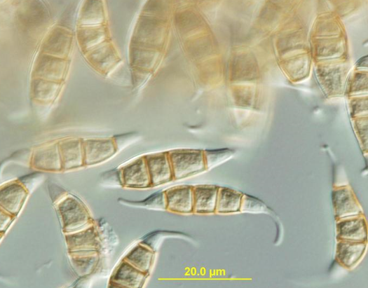 병원균(분생포자)