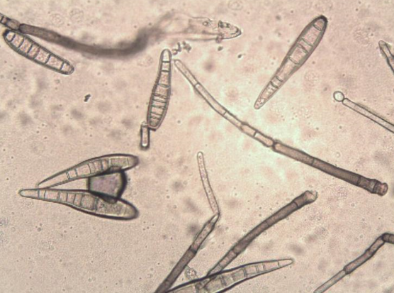 병원균(분생포자)