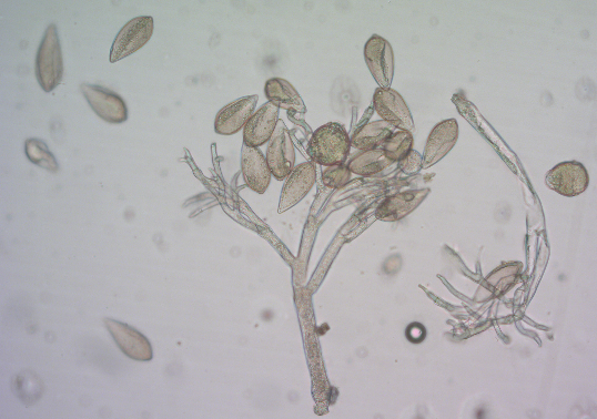 병원균(유주자낭)