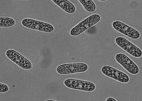 병원균(분생포자)