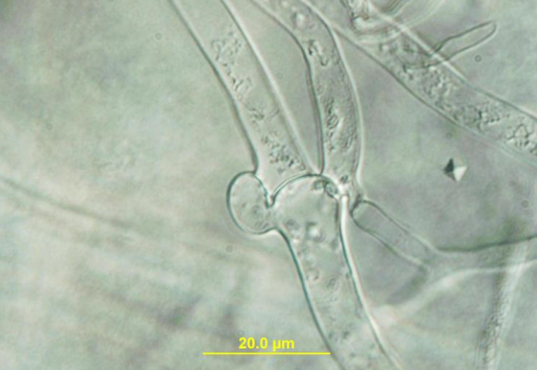 병원균(균사 접합 꺽쇠연결)