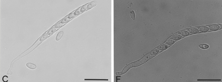 자낭과 자낭포자, 병원균(좌 : S. sclerotiorum, 우 : S. minor)