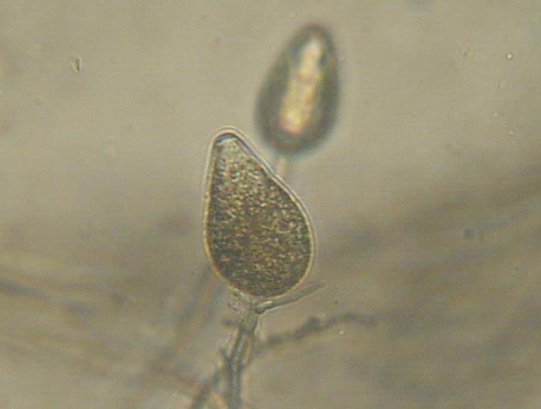 병원균(유주자낭)