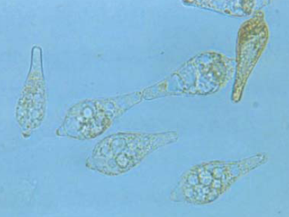 병원균(분생포자)