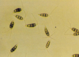 병원균(분생포자)