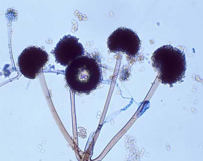 병원균의 포자낭