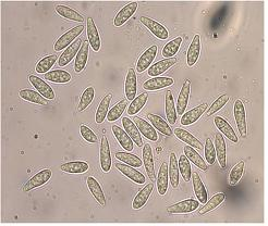 병원균(병포자)    