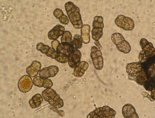 병원균(분생포자)
