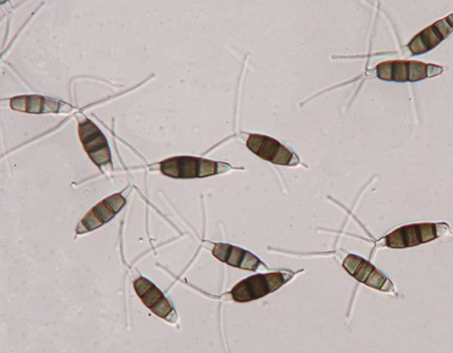 병원균(분생포자)