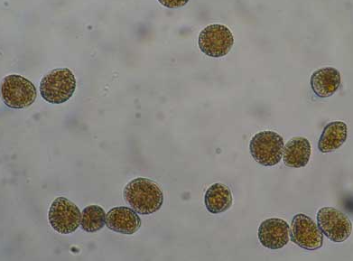 병원균(하포자)