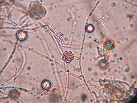 병원균 (난포자)