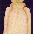 뿌리 유관속 갈변