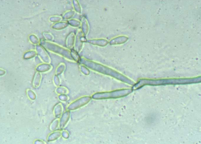 병원균(분생포자)