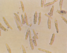 병원균(분생포자)