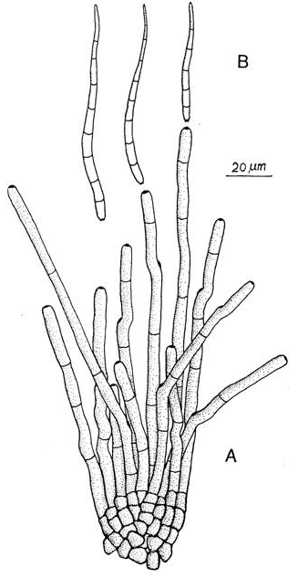 병원균(A : 분생자경, B : 분생포자)